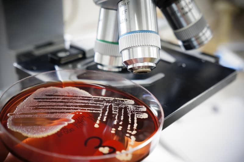 A microscope with a bacterial culture dreamstime_s_25385258